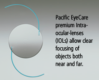 Pacific EyeCare IOLs
